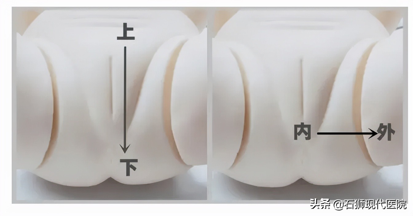 阴唇粘连？“假性月经”？分泌物……你担心的问题都有答案了