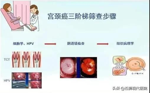 想预防宫颈癌，光打HPV疫苗不够！21岁开始别忘了做这件事