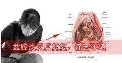 盆腔炎的5大常见诱因，女性不可不防！