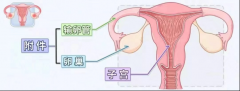 磨人的“小妖精”——盆腔炎