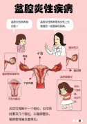 女性必看的盆腔炎护理手册！