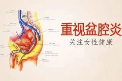 女性朋友的苦不堪“炎”——盆腔炎