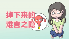 别让子宫“脱垂”惊慌了母亲的岁月