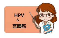 感染了HPV就必定得宫颈癌吗？