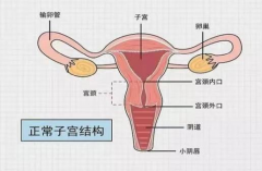 关于子宫肌瘤知识