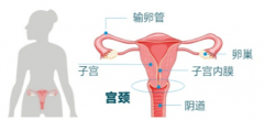 打败“红颜杀手”！宫颈疾病早期发现