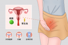 这三个秋季高发的妇科疾病一个比一个