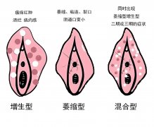 崩溃！“啪啪啪”时“痛痛痛”？痒痒